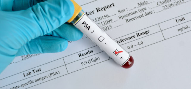 Meestearst: kodune PSA test ei tööta Meestearst: kodune PSA test ei tööta
