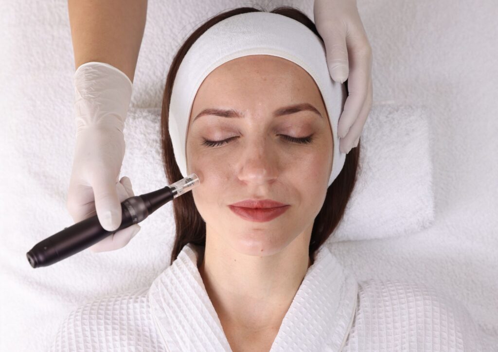 Microneedling with Exosome or PDRN Serum